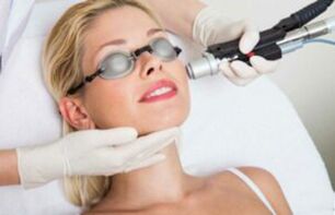 Laser gezichtshuidverjongingsprocedure