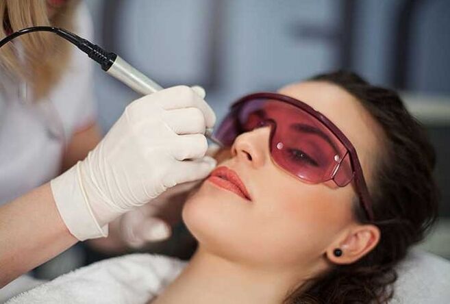 Laser biorevitalisatie