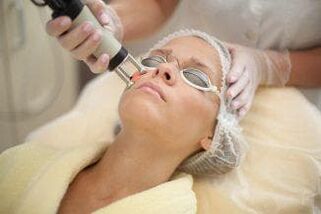 procedure