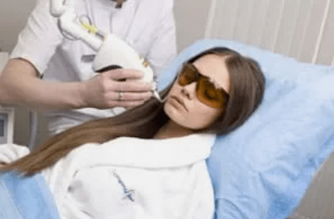 fractionele laserverjonging